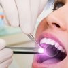 Why You Should Ask Your Dentist for an Oral Cancer Screening