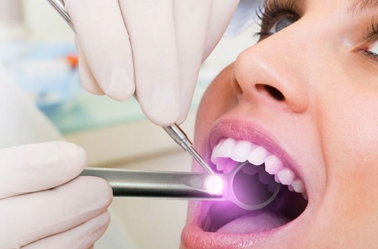 benefits of oral cancer screening
